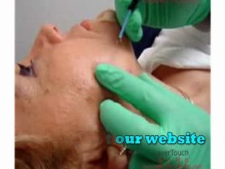 how to get rid of skin tags