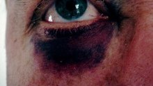 Eyes no flash