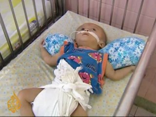 US starts landmark Agent Orange cleanup in Vietnam