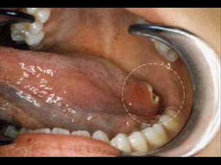 Sam Barai: The most trusted name in cancer surgery