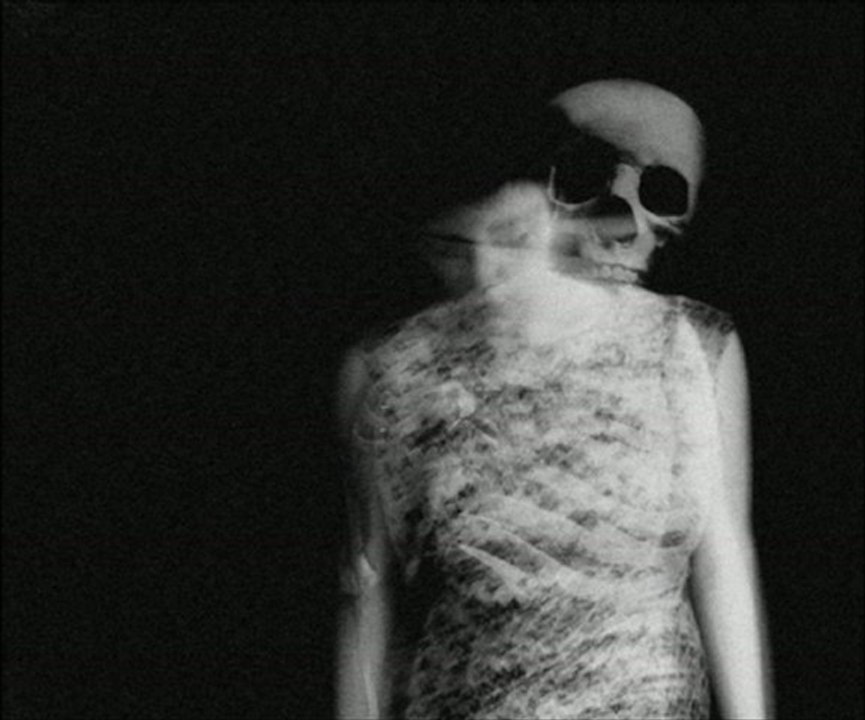 She Past Away - Bozbulanik