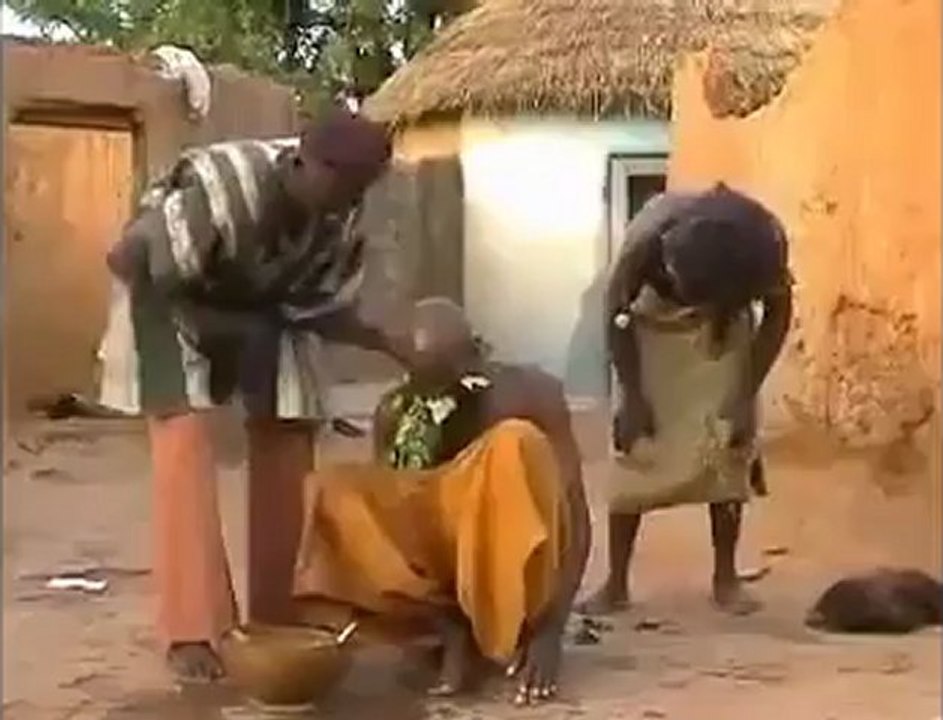 Migren Tedavisinde Son Nokta