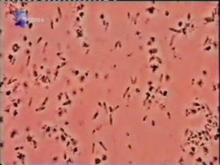 Bacterias y virus extremofilos: El lago rosa (Retba)