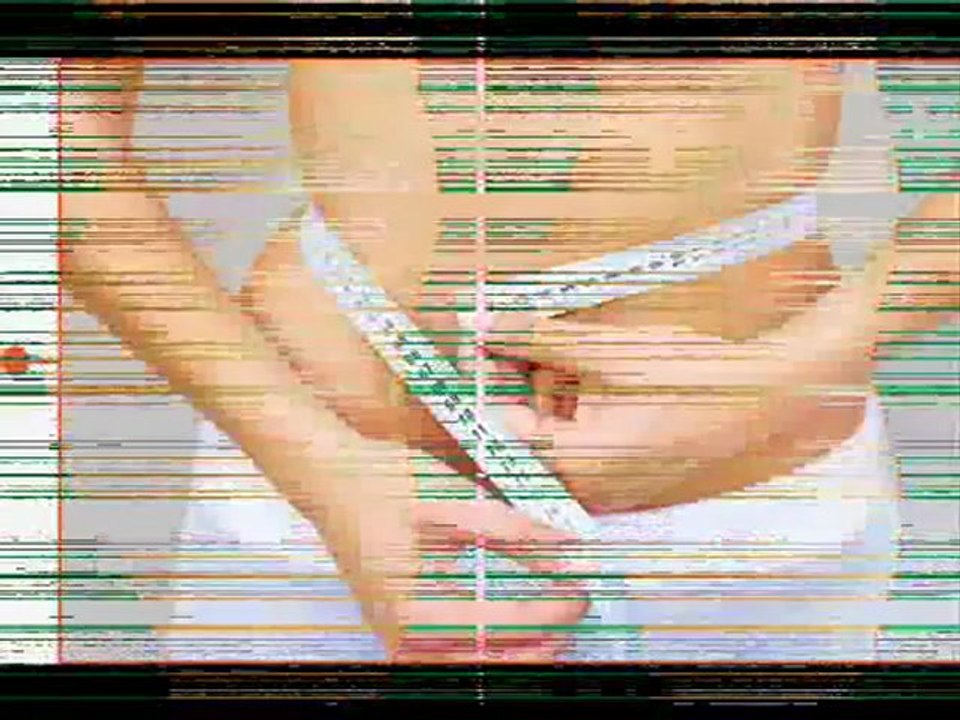 Liposuction is a popular surgery procedure?