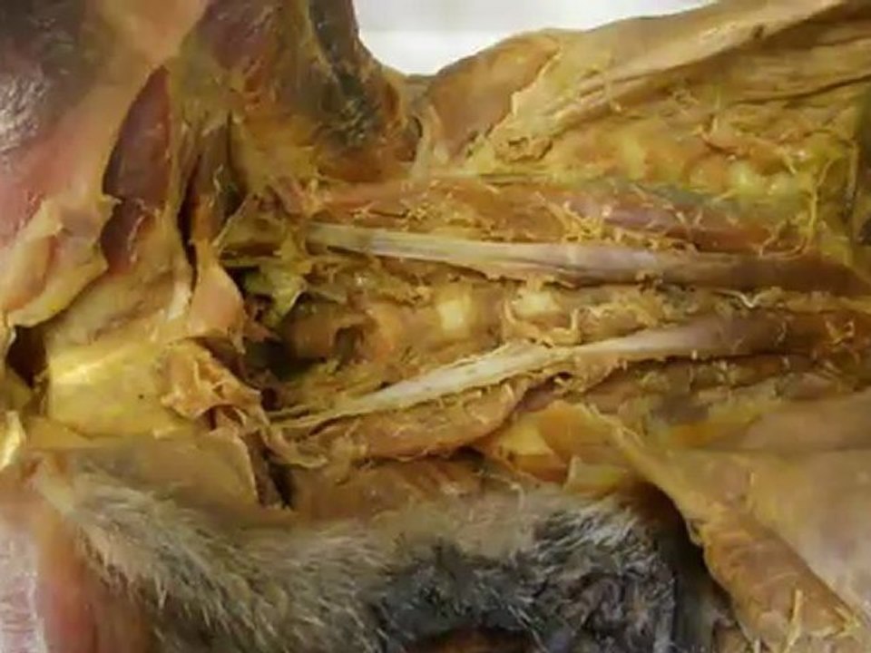 Anato I psoas menor , psoas mayor , cuadrado lumbar , iliaco