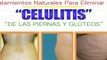 Como Eliminar Celulitis y estrias-[Eliminacion Celulitis]
