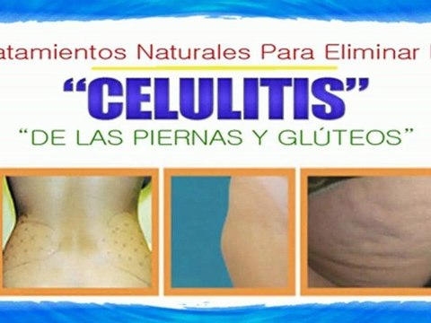 Como Eliminar Celulitis y estrias-[Eliminacion Celulitis]