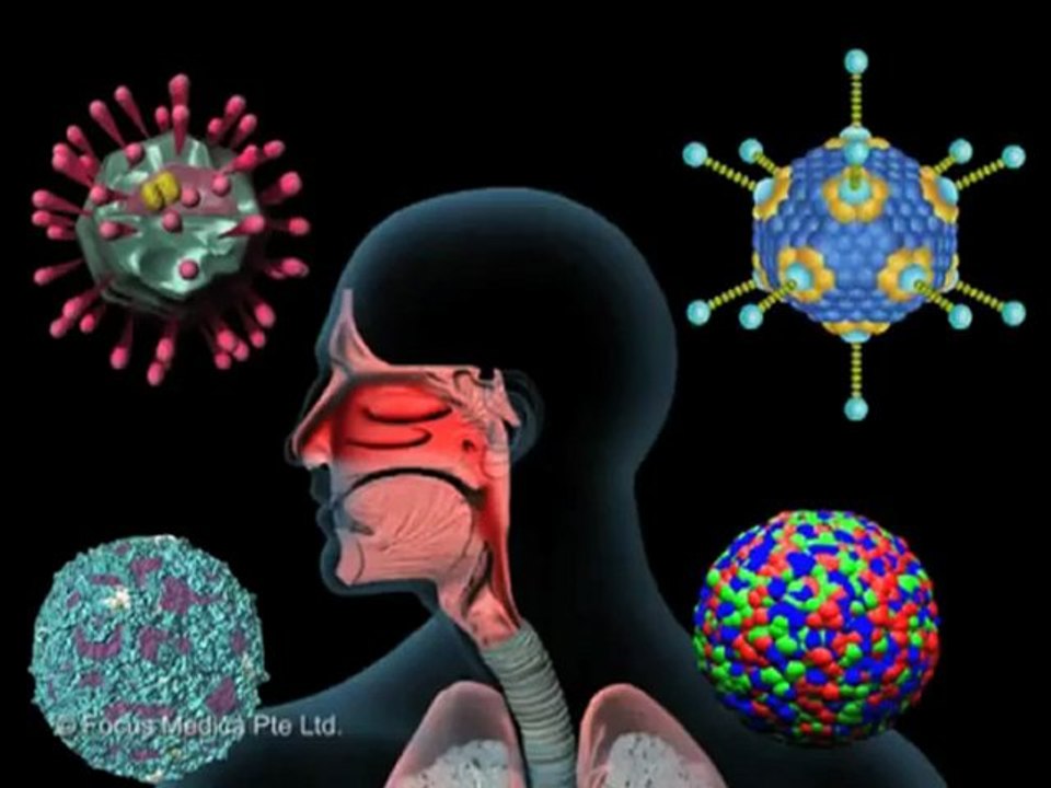 Upper Respiratory Tract Infections - URTI (Understanding Disease_ Infectious Diseases & Oncology)