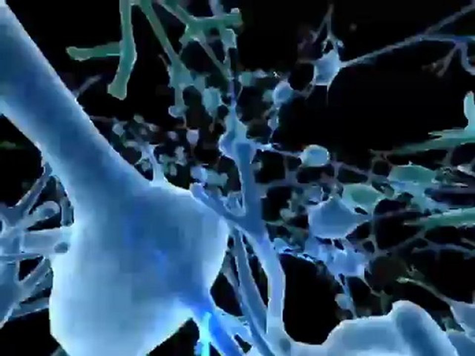 Alzheimer's Disease (Understanding Disease_ Neurology)