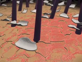 Dandruff (Understanding Disease_ Dermatology)