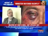 Height of high handedness: Beaten By Min's Men, Cop Speaks Out