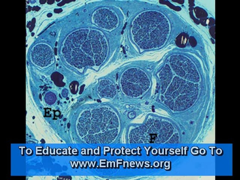 Cell Tower Radiation Dangerous (Radiation Meters) Cell Tower Radiation Dangerous