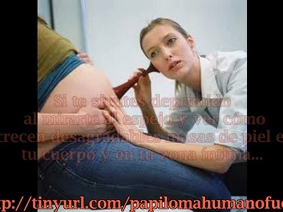 CONDILOMA EN EL EMBARAZO