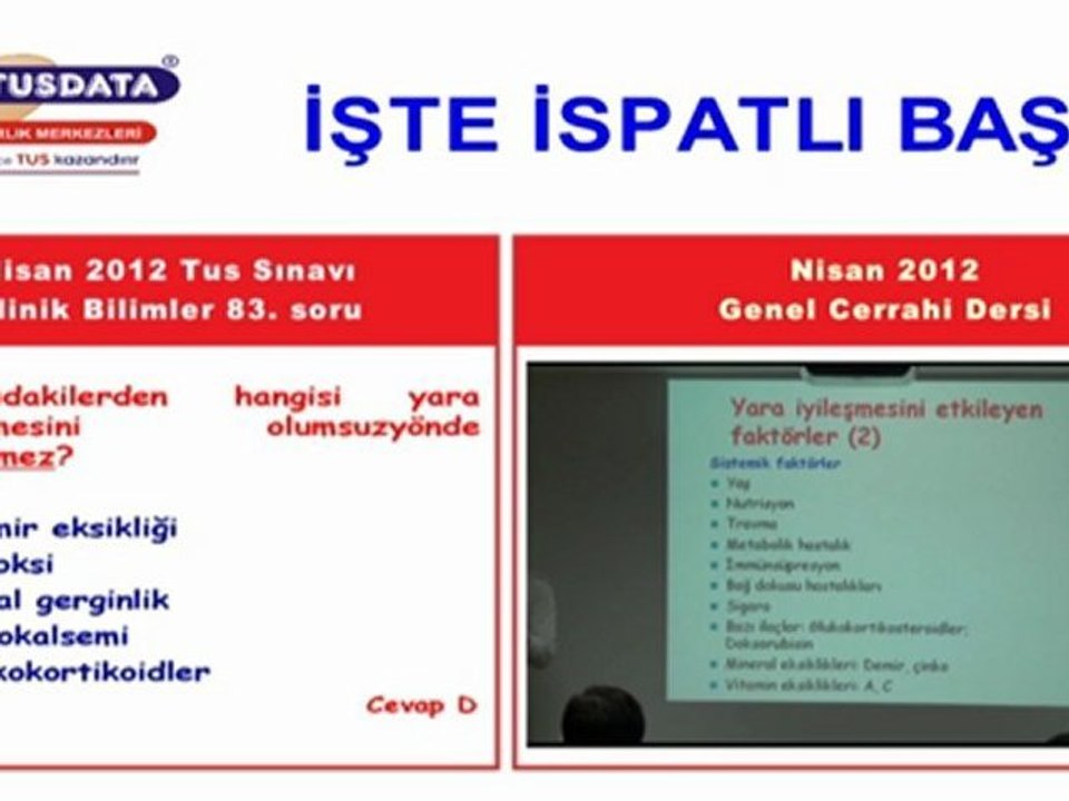 Nisan 2012 Tus Genel Cerrahi 83.soru