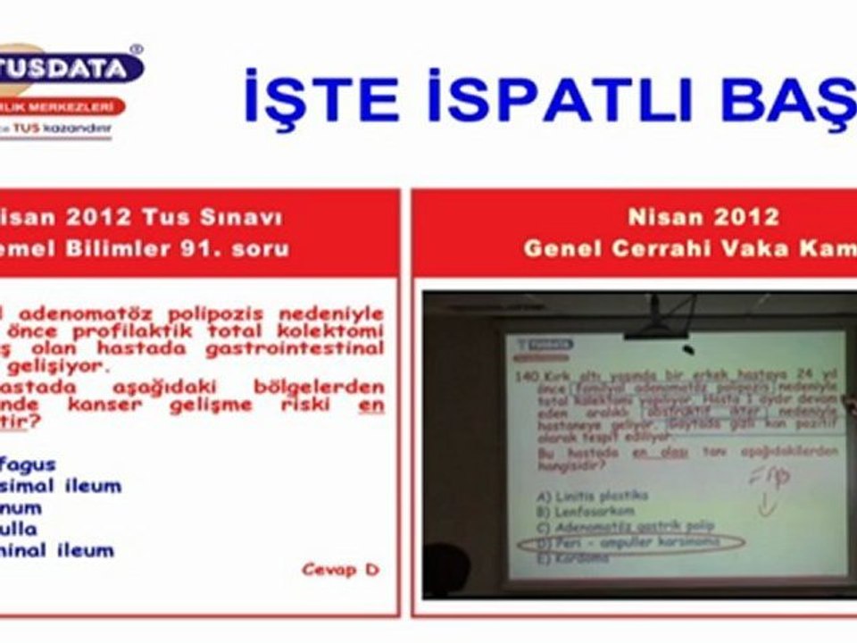 Nisan 2012 Tus Genel Cerrahi 91.soru