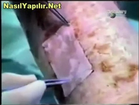 Deri Nakli Nasıl Yapılır? | NasılYapılır.Net |