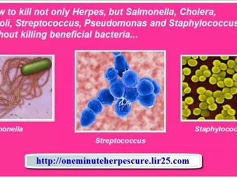 symptoms of oral herpes - herpes zoster treatment - herpes zoster infection