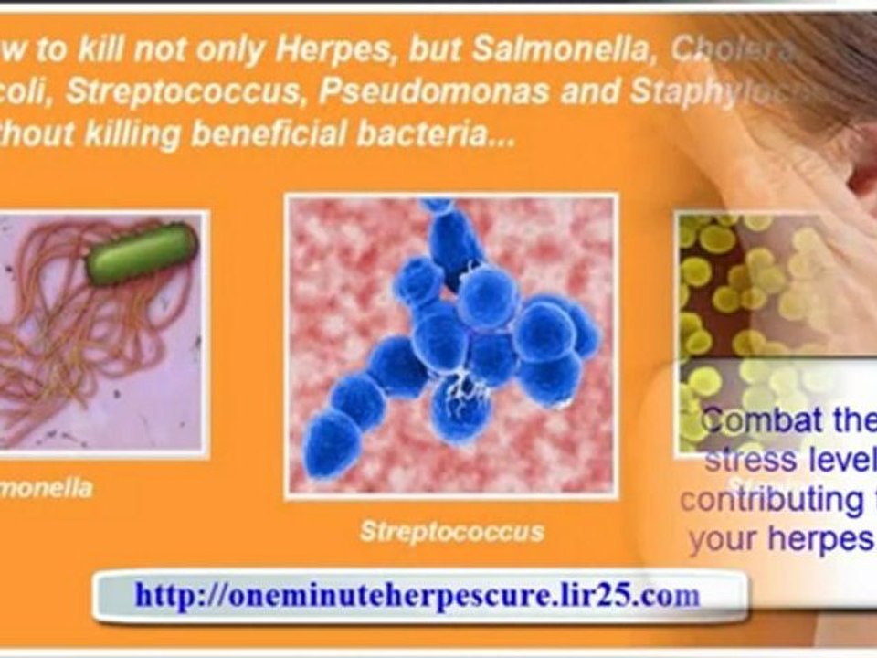 herpes simplex virus 1 - herpes simplex virus 2 - herpes cure