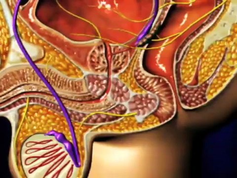 Benign Prostatic Hyperplasia - BPH (Understanding Disease_ Gastroenterology & Urology)