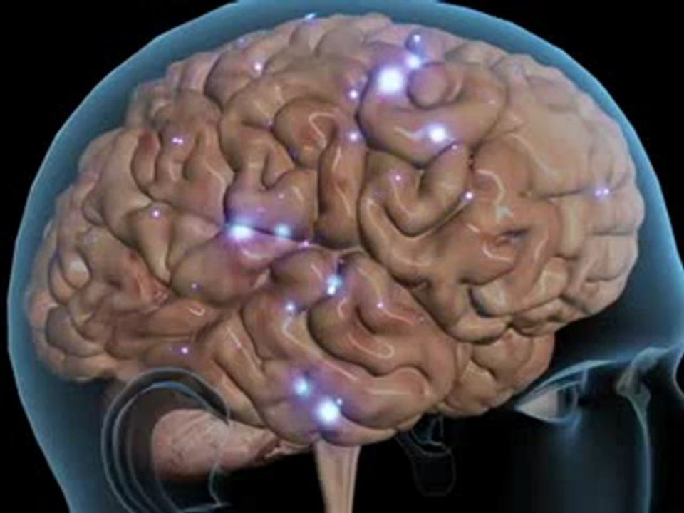 Epilepsy (Understanding Disease_ Neurology)