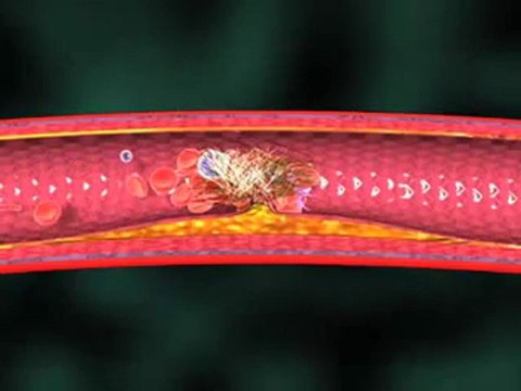 Metabolic Syndrome (Understanding Disease_ Diabetes & Endocrinology)