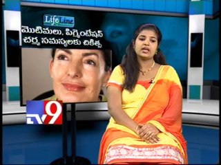 Cure for pigmentation - Life Line