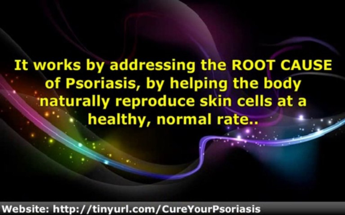 Cure Your Psoriasis in Days
