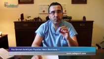 Yüz Germe Estetiği Fiyatı & Dr Ali Mezdeği