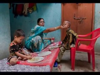 The boy with the body of a 110-year-old- Ali Hussain Khan