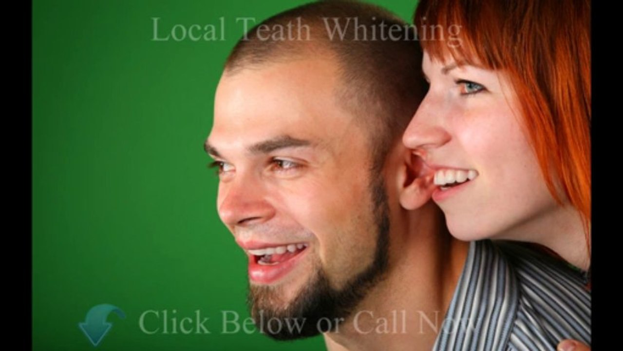 Teeth Whitening By Dentist Calgary - For Great Service Call (877)927-2387