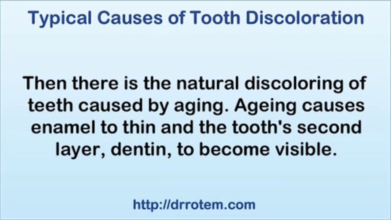 Don't Let Tooth Discoloration Stop you From Having White Teeth