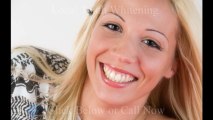 Teeth Whitening At Dentists Saskatoon - Call Now (877)732-9136