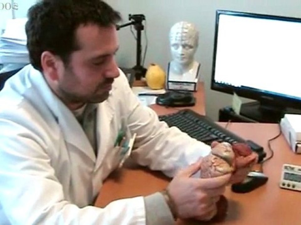 Rehabilitacion de daño cerebral: Alvaro Bilbao (CEADAC)
