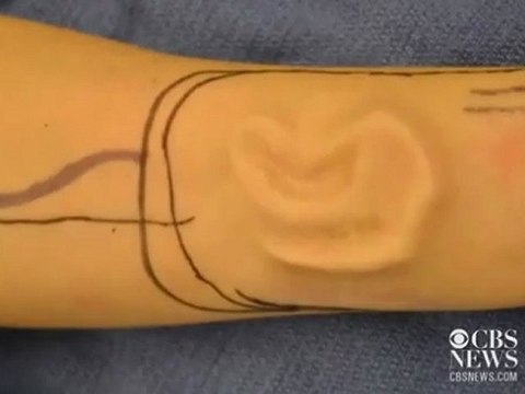 Oreille dans le bras