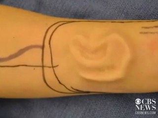 Oreille dans le bras