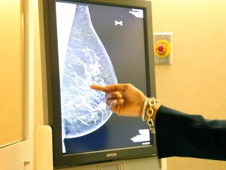 Hologic Exhibits New 3D Mammography Technology At NASDAQ