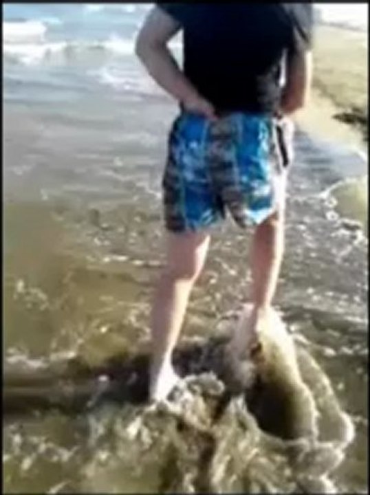 Hémiplégie avec jambe plus courte, marche en bord de plage