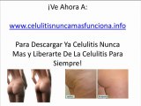 Remedios Caseros Para La Celulitis - Elimina La Celulitis Naturalmente