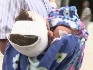 Syrie: de nouveaux civils blessés à Alep