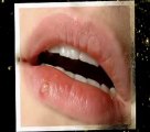 Cold Sores On Lips