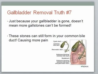 The Shocking Truth About Gallbladder Removal