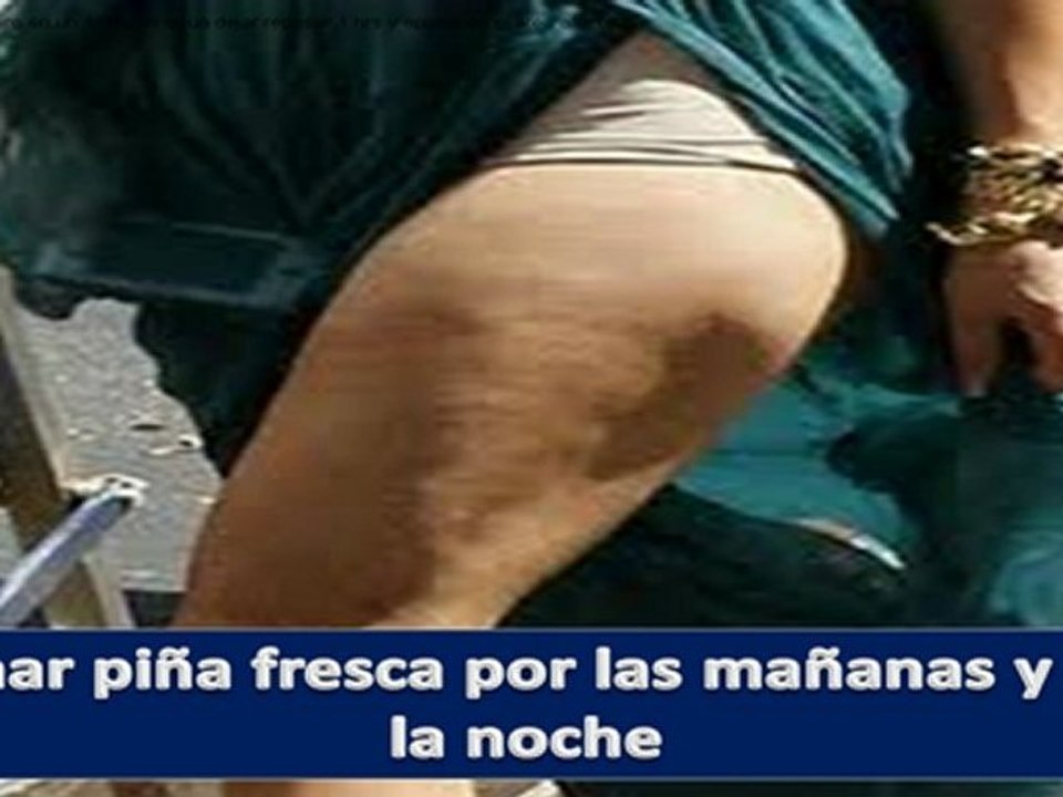 Disminuir la celulitis-Como Quitar Celulitis