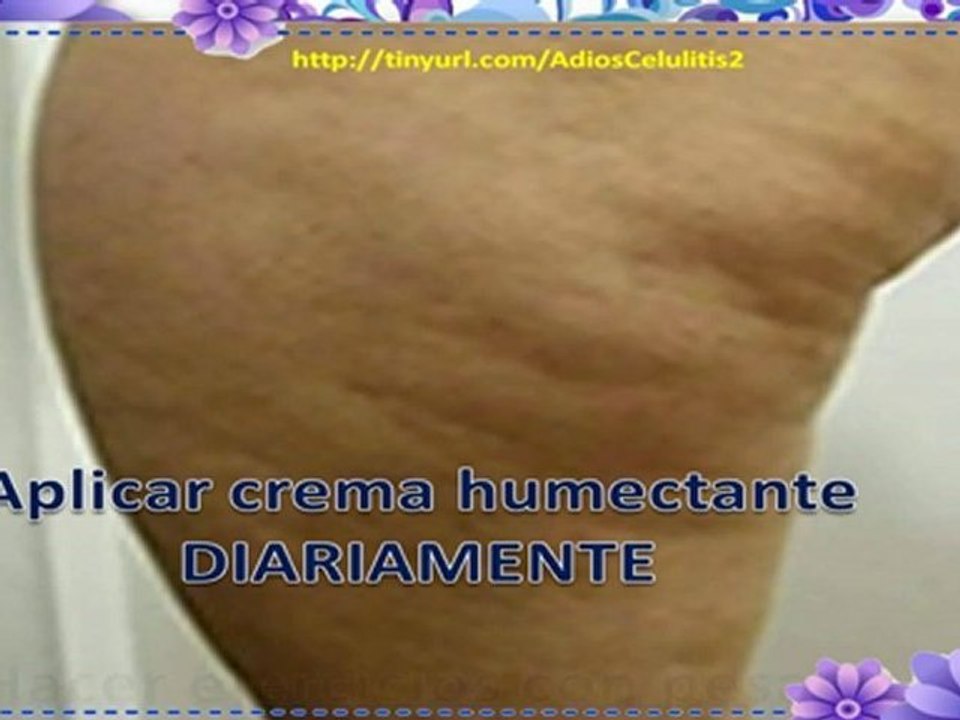 Como Eliminar la Celulitis rapidamente