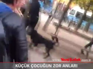 Köpek, küçük çocuğa böyle saldırdı