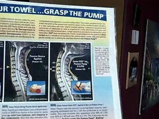 Proper neck curve using the Posture pump on Hump Day Realignment