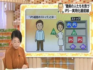 20121009 ノーベル賞の山中教授 難病の患者を救うために