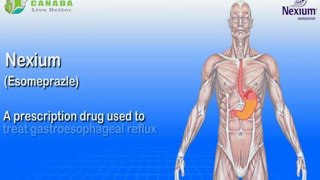 Nexium (Esomeprazle) - Treatment for Stomach Problems