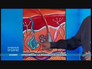 Comment Stopper la Transpiration Excessive