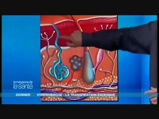 Comment arrêter la Transpiration Excessive