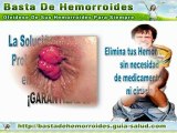 Remedios Caseros Hemorroides
